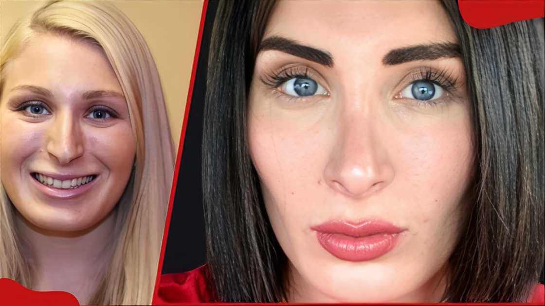 laura loomer plastic surgery